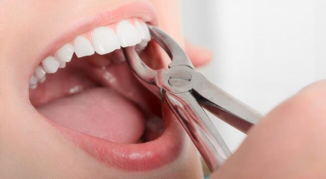 نخ دندان کشیدن یکی از راه‌های مراقبت از دهان و دندان است که باعث می‌شود دندان‌های شما در مدت زمان طولانی‌تری سالم بمانند