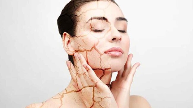 یکی از روش‌های درمان خشکی پوست استفاده از روغن نارگیل در روتین روزانه است.