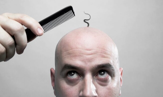 مردی با شانه ای در دست را در تصویر میبینیم که تنها چند تار مو بر روی سر خود دارد و عملا شانه به کار او نمی‌آید. این مقاله در رابطه با ریزش مو در سنین و افراد مختلف است.
