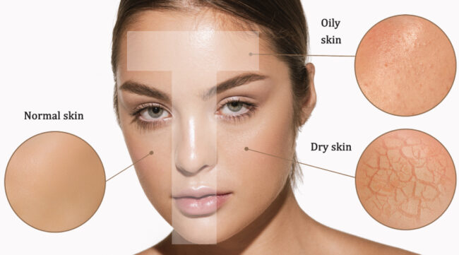 اولین گام در طراحی روتین بهینه مراقبت از پوست شما این است که تعیین کنید دارای کدام یک از انواع مختلف پوست هستید.