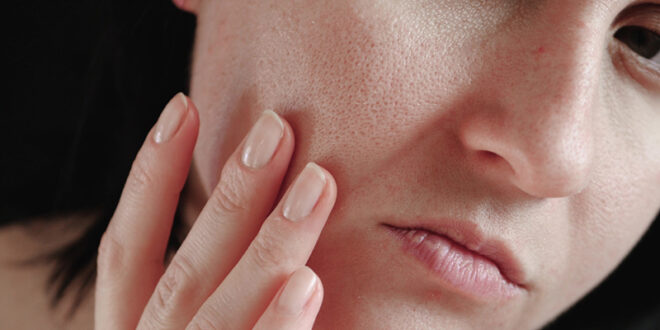 دستیابی به پوستی صاف