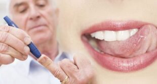 تاثیر دیابت بر سلامت دهان و دندان